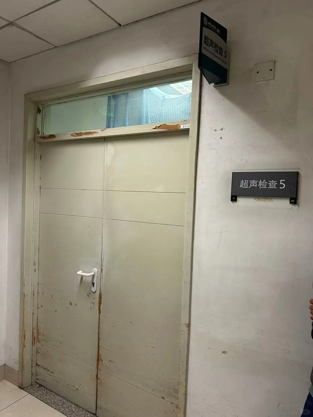 脖子粗以为是甲状腺，医生大声笑着说是胖的