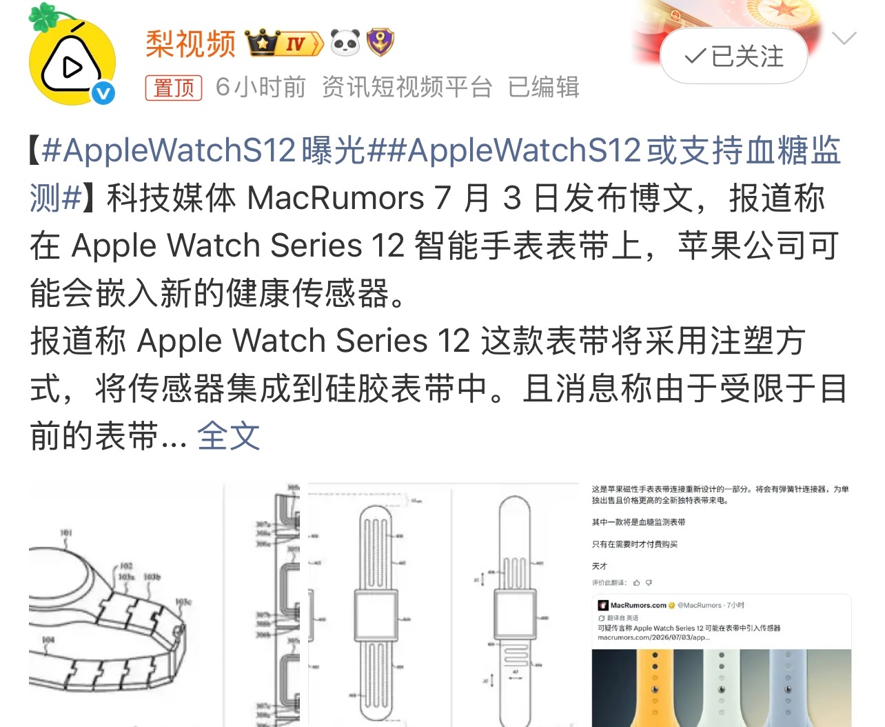 AppleWatchS12曝光据报道， Apple Watch Series 1
