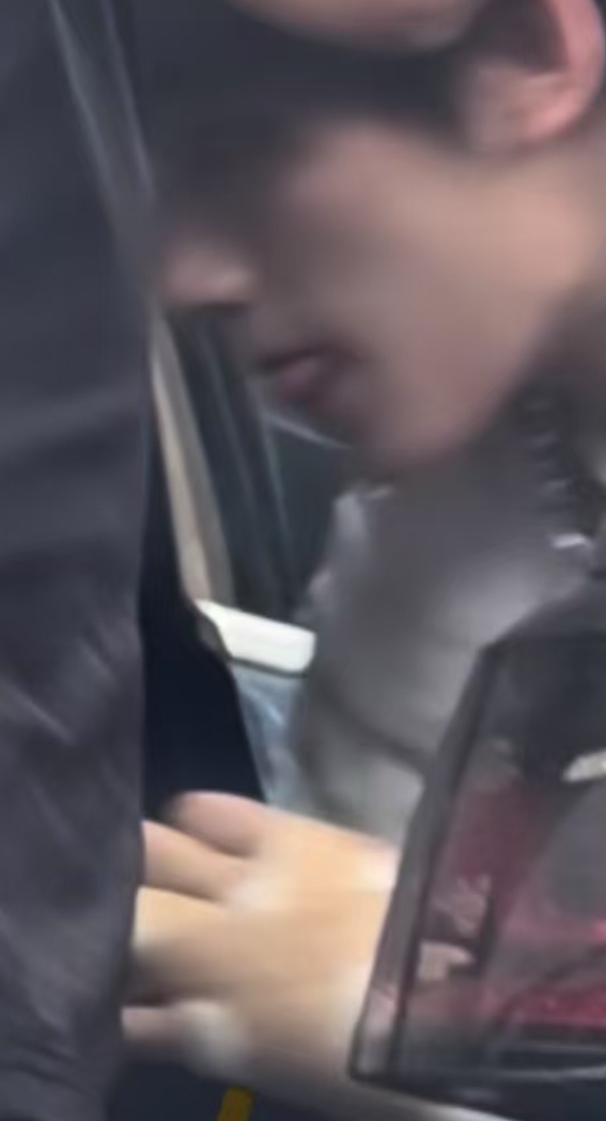 第一次这么近距离的看到被包扎的手 