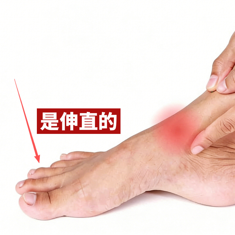 一个观察：每个人的脚趾头，状态也是不同的。放松的时候，有人脚趾是弯曲的，有人是直