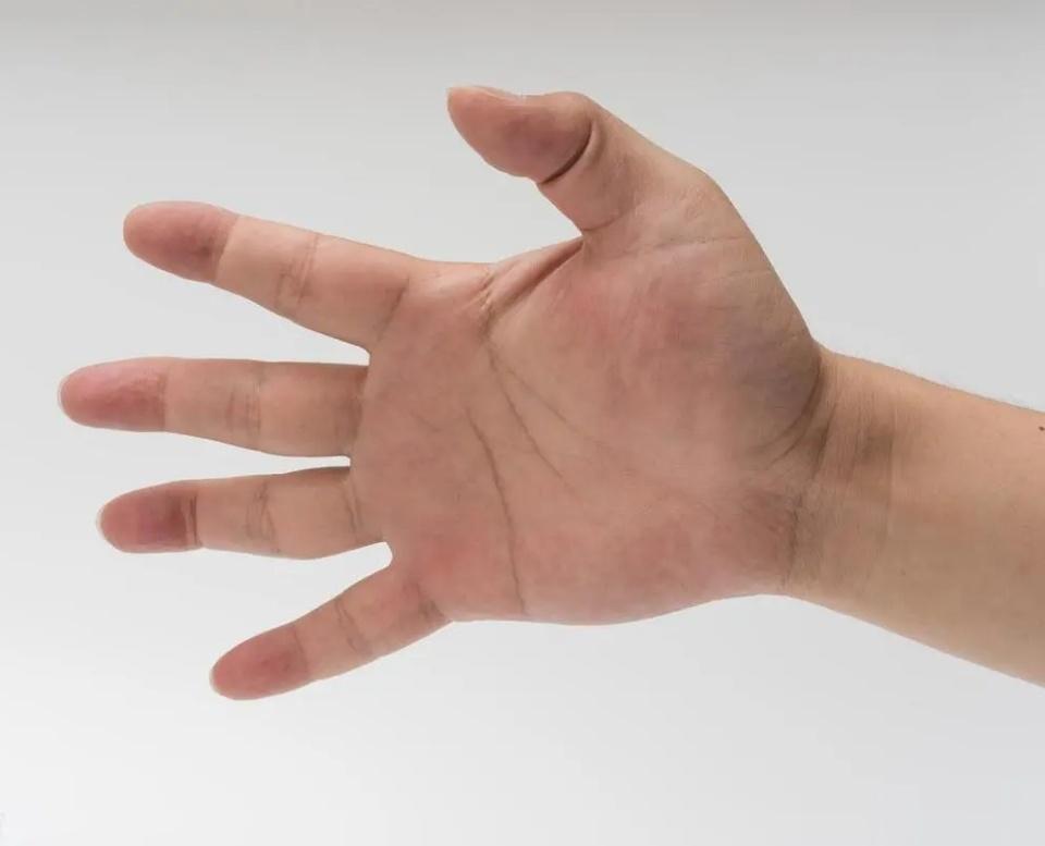 手指锻炼能预防老年痴呆　　1、 按摩双手。手指伸直，用右手掌按摩左手背，接着用左