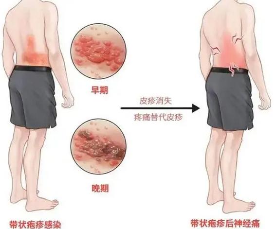 防不胜防！湖北一女子在拆完快递之后揉了揉眼，没想到就是这一个小小的举动，直接把她