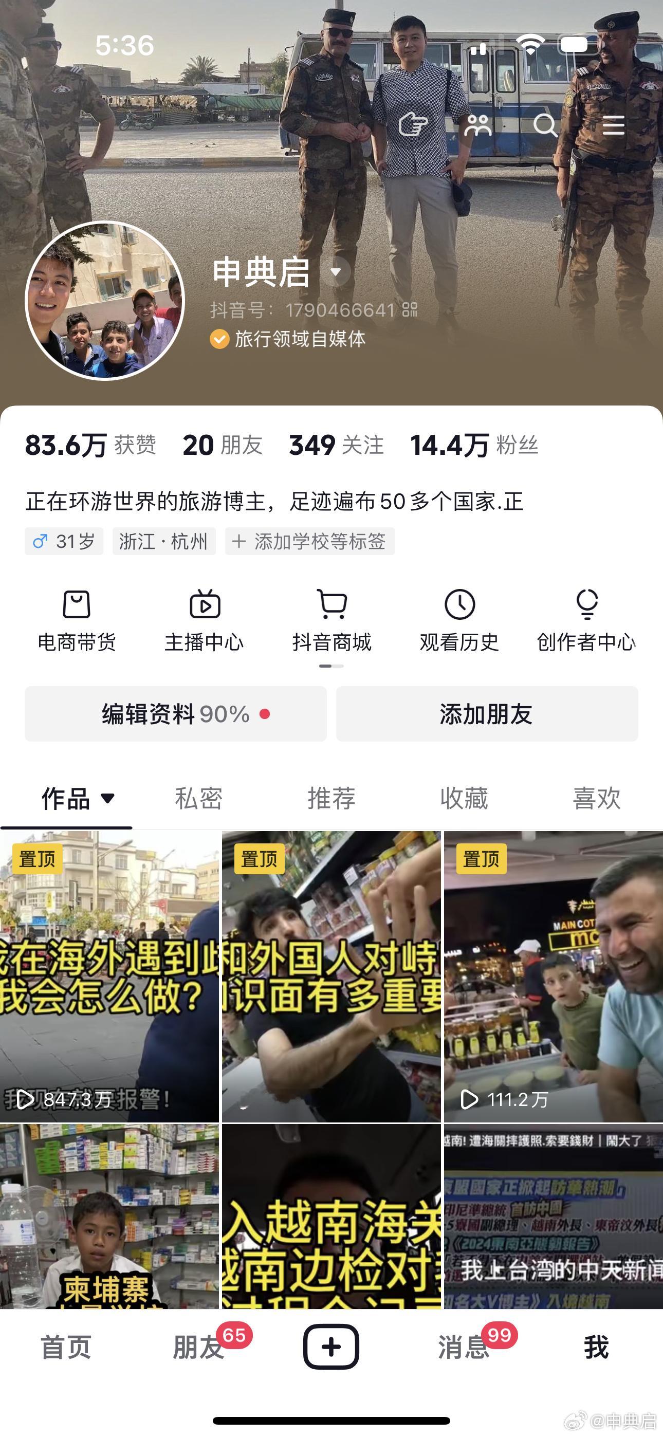 我的抖音啥都没发，就打了老外小孩一巴掌，就涨了5000粉丝[允悲]  ​​​