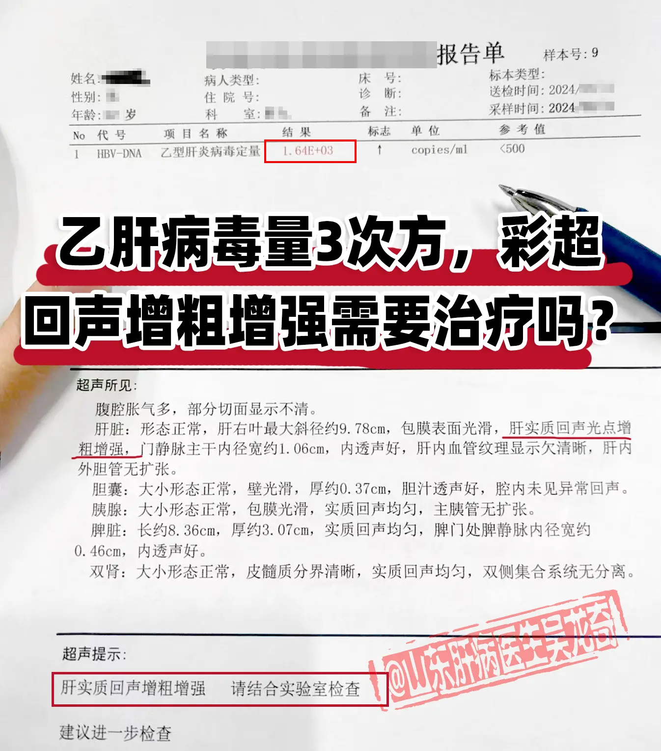乙肝病毒量3次方，彩超回声增粗增强需要治疗吗？ 来自聊城的小三阳患者...