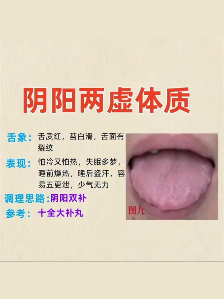 ·阴阳两虚体质：舌象：舌淡，舌苔薄白，舌形胖大或有齿痕。表现：畏寒肢冷，面色苍白