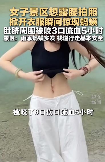 6月4日，据报道，云南丽江蓝月谷景区发生了一起游客被蚂蝗叮咬的户外意外。

六月