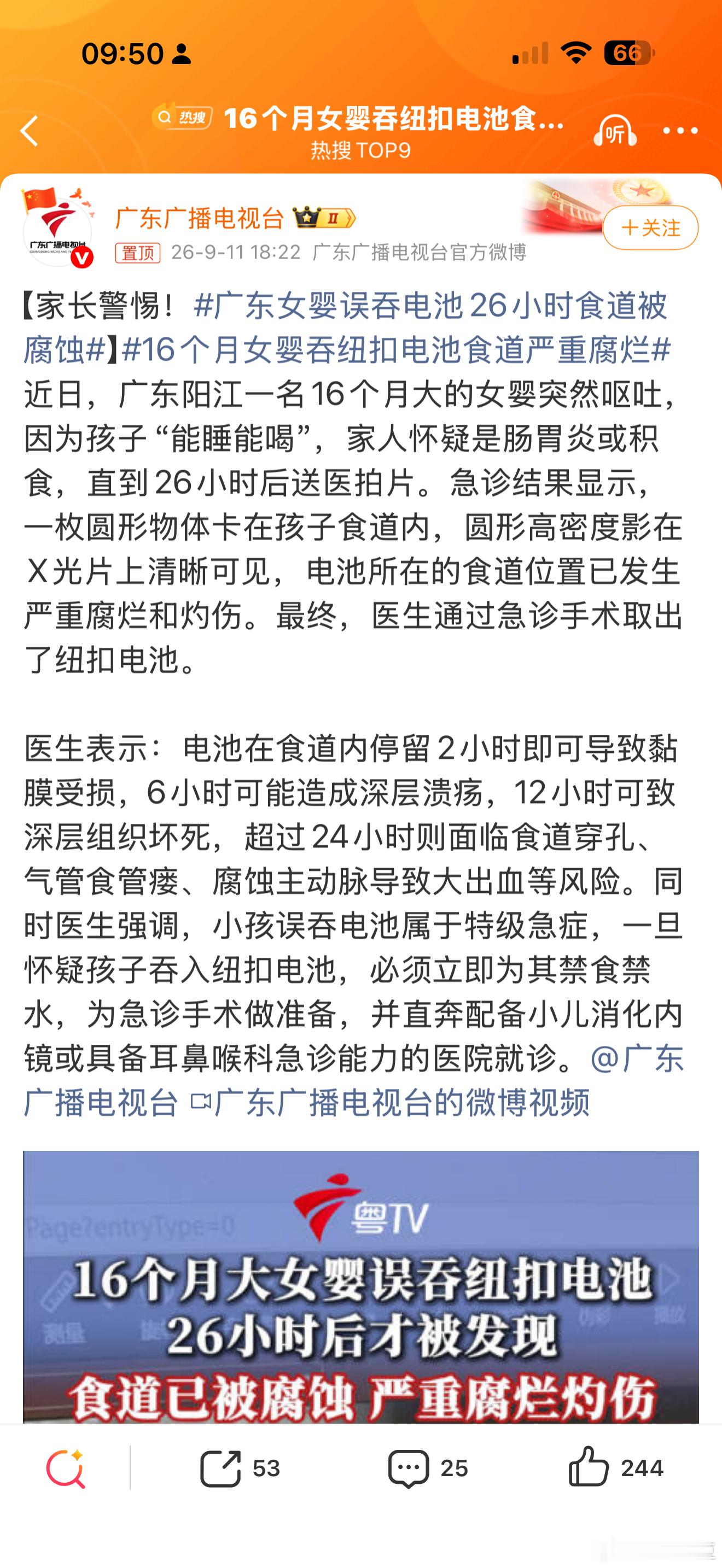 广东女婴误吞电池26小时食道被腐蚀这监护人也太粗心大意了，不过吞进去也太可怕了 