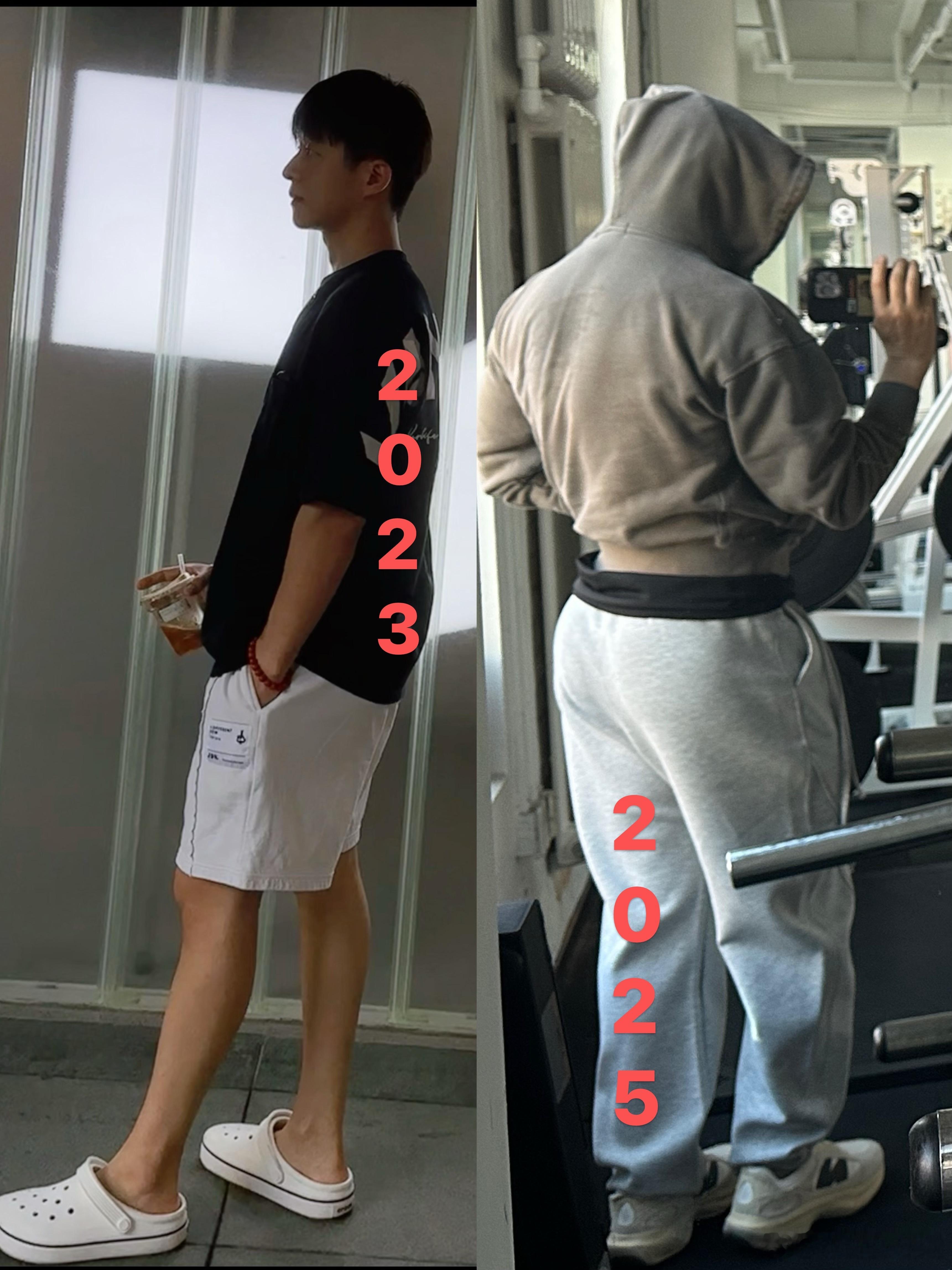 健身张宏涛 2019 开始接触健身 20231 月颈椎压迫神经 肌肉无力逐渐萎缩