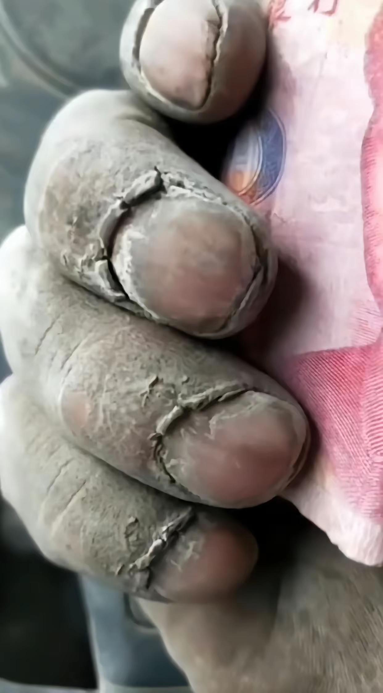 差别啊？
没有左面这只粗糙而又裂迹斑斑的劳动之手，何有右面这圆润光滑细腻的玉手，