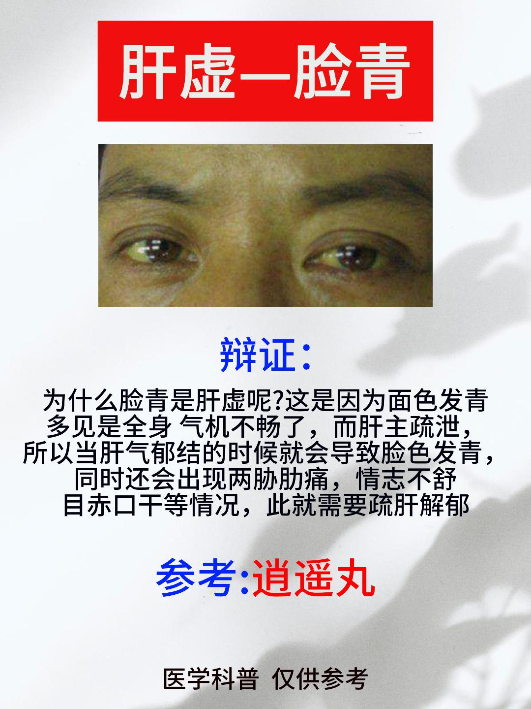 五脏情况怎么样？看看脸色就知道！心虚脸红，肾虚脸黑，肺虚脸白，脾虚脸黄，肝虚脸青