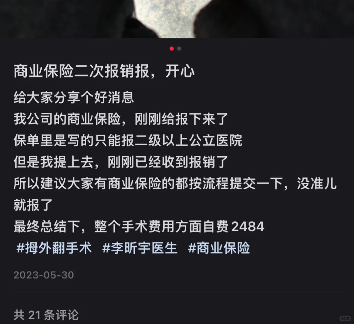 关于拇外翻手术费用问题