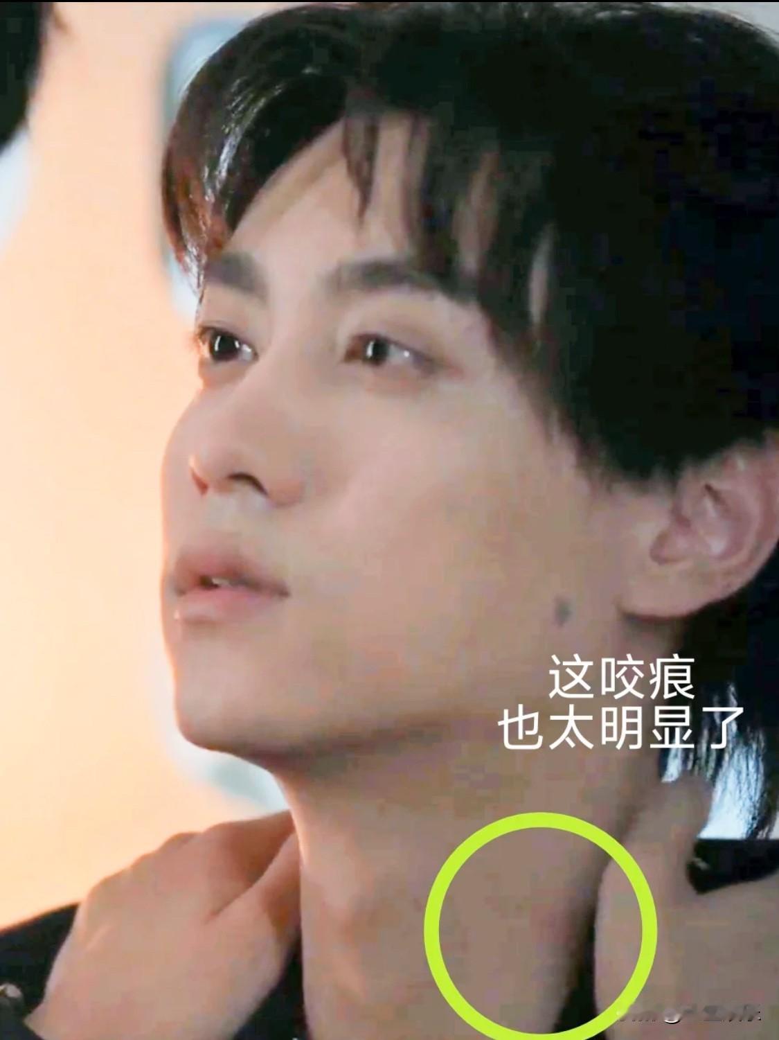 不儿？都咬出🍓印了啊！
我天呢调高亮度发现竟然是真下嘴咬了啊！紫玉都给小田咬出
