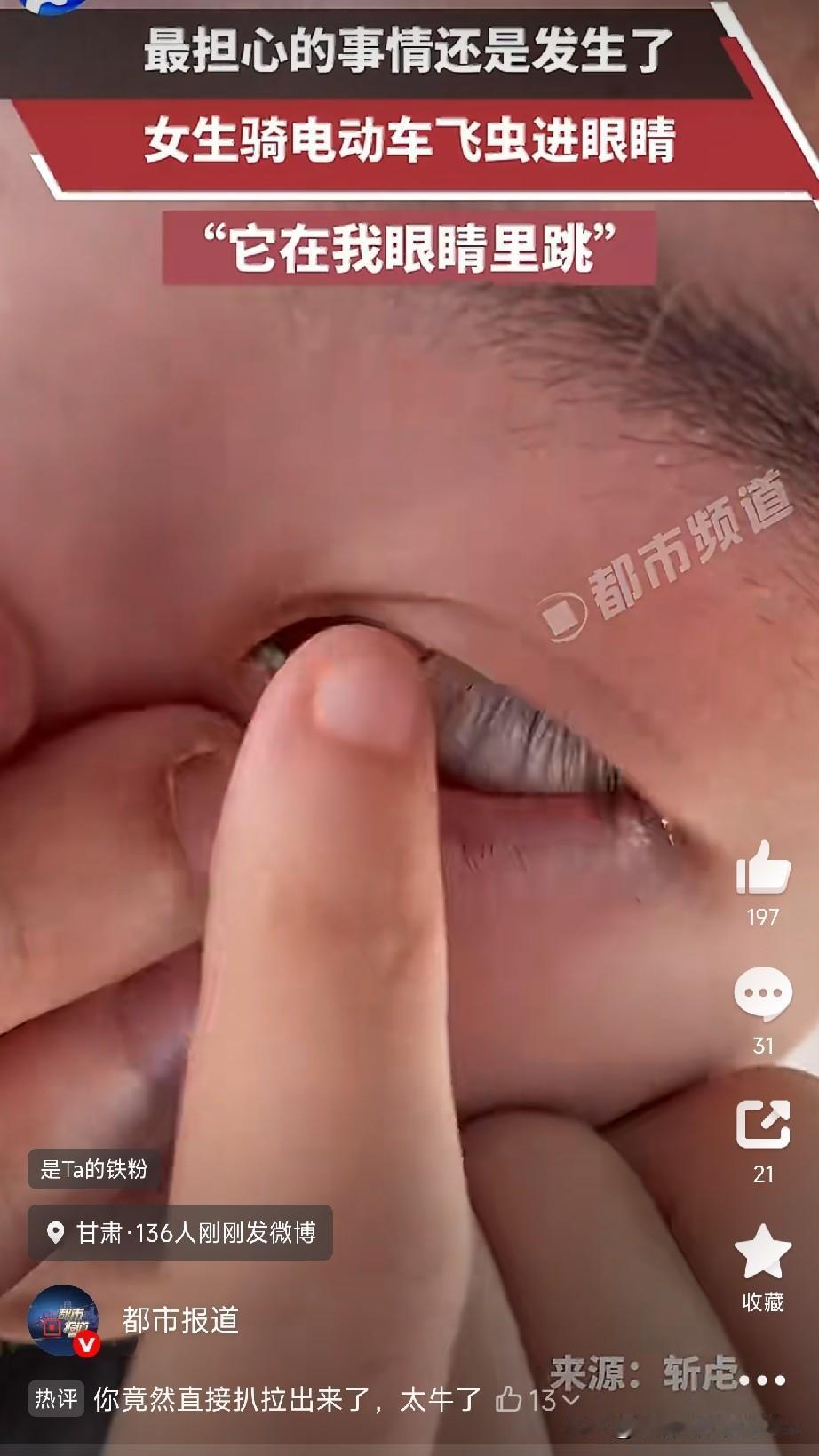 千万别学这位大姐，
拿眼角膜不当回事

事情是这样的，7月22号，甘肃一位女士正