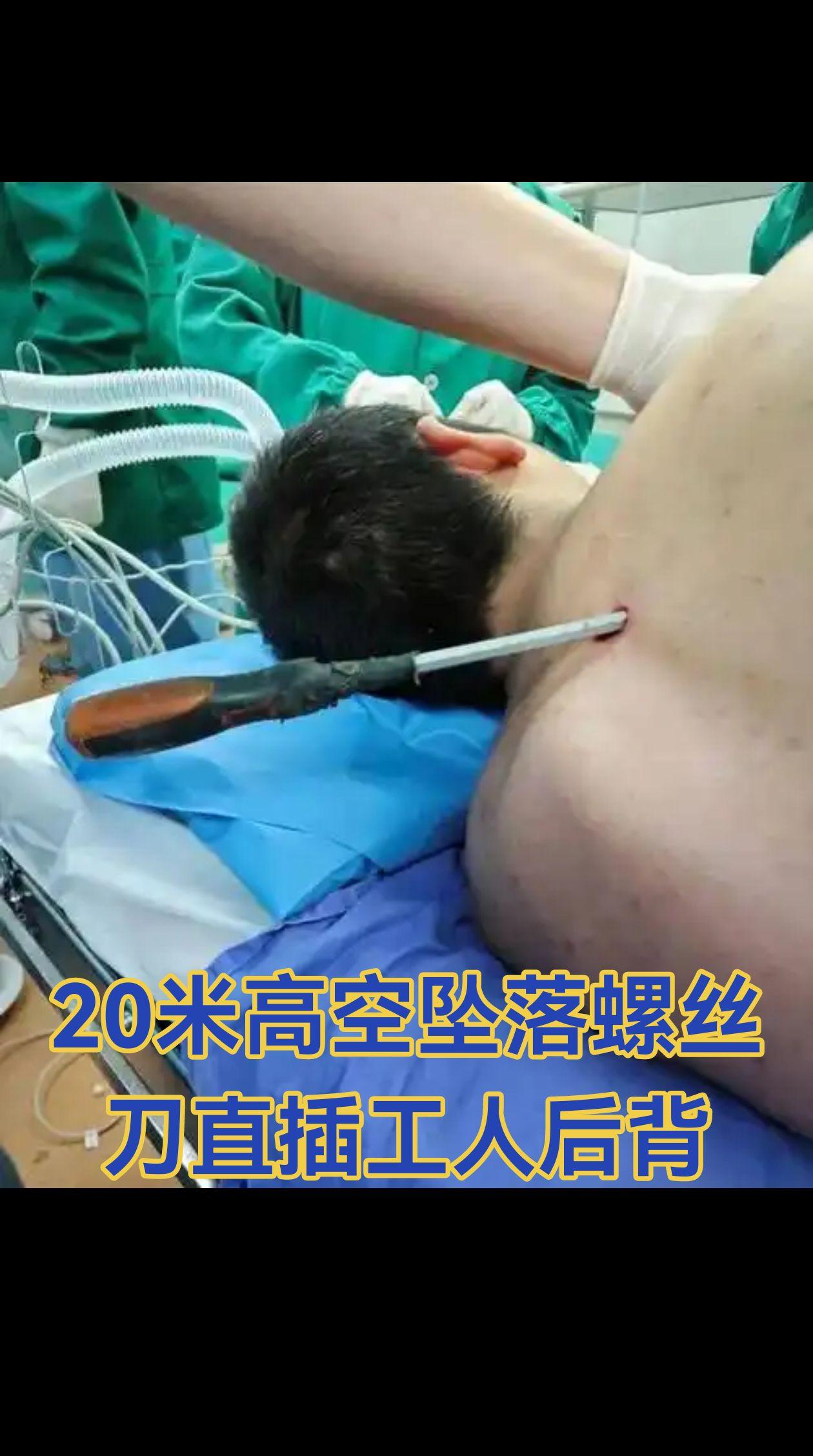 高空坠落螺丝刀直插工人后背