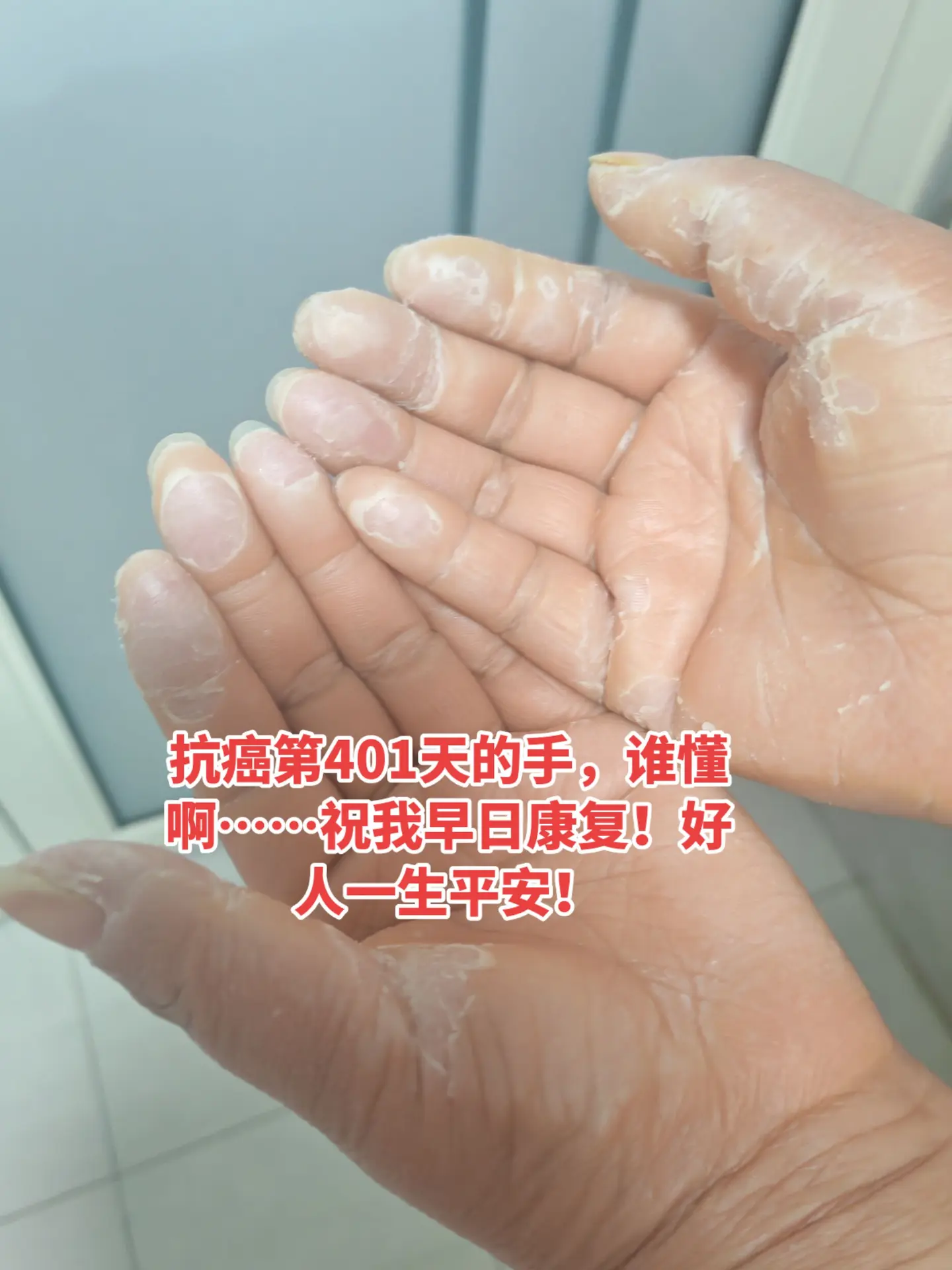 虽然这条路很艰难，但我不会放弃，我会坦然面对，只要能活着就好！