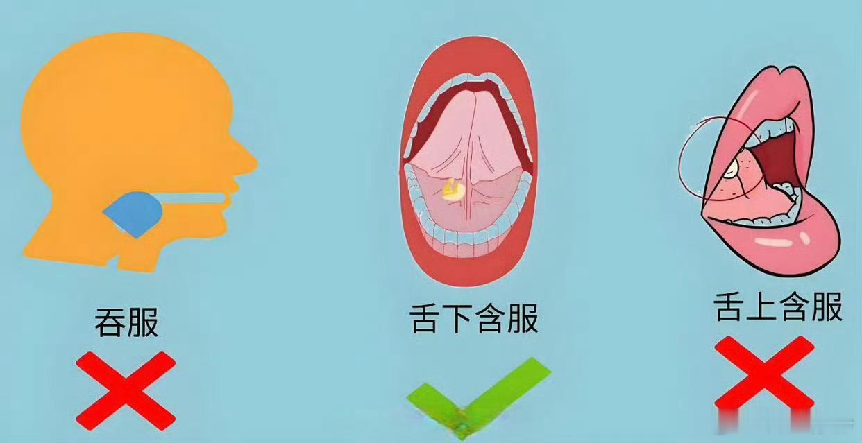 速效救心丸 舌下含服舌下含服是速效救心丸发挥急救作用的核心操作，它巧妙利用人体解