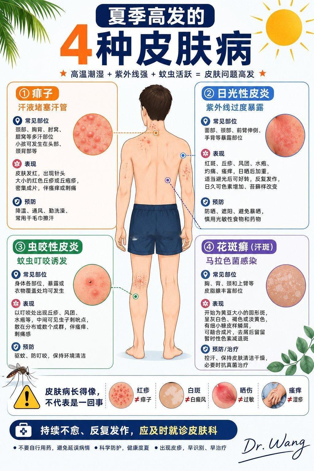 夏季高发的4种皮肤病 