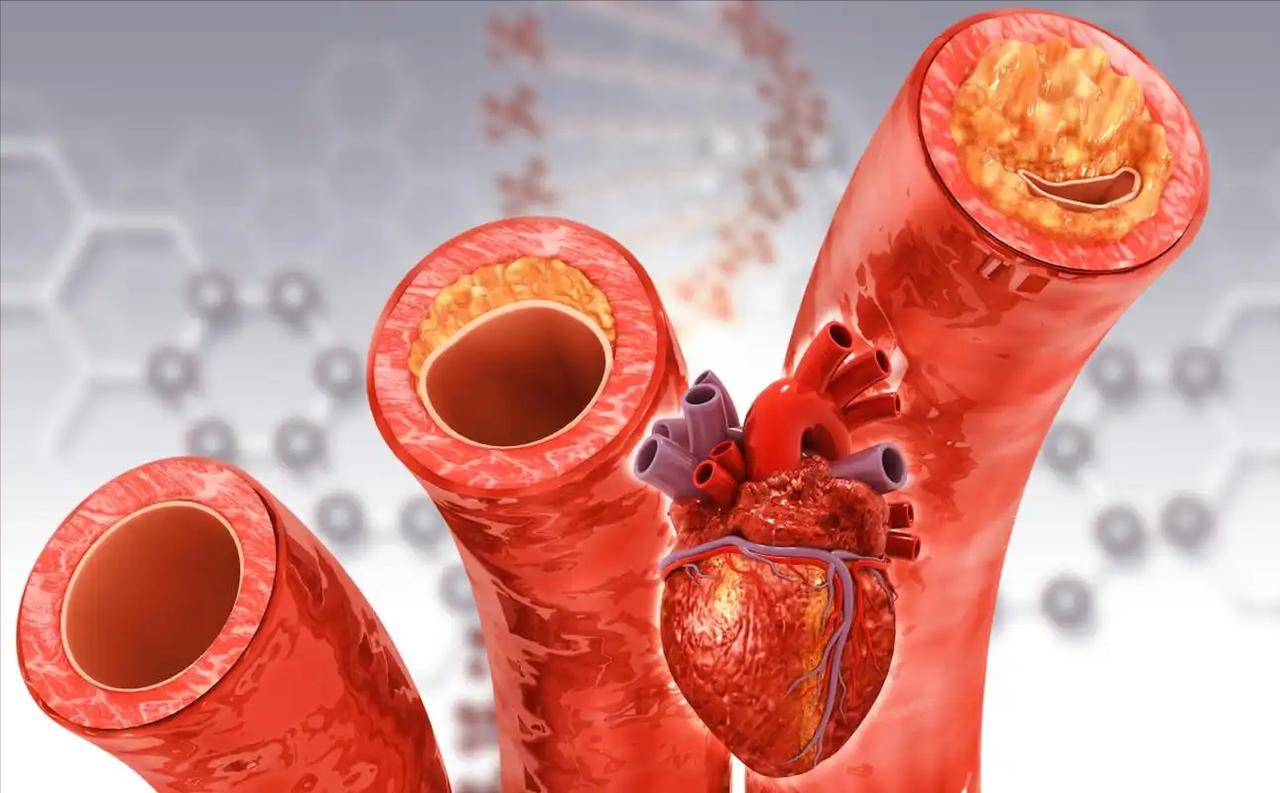 这些症状可能暗示血管堵塞？想要保护血管，牢记这四个关键点！
 
一开始就是很正常