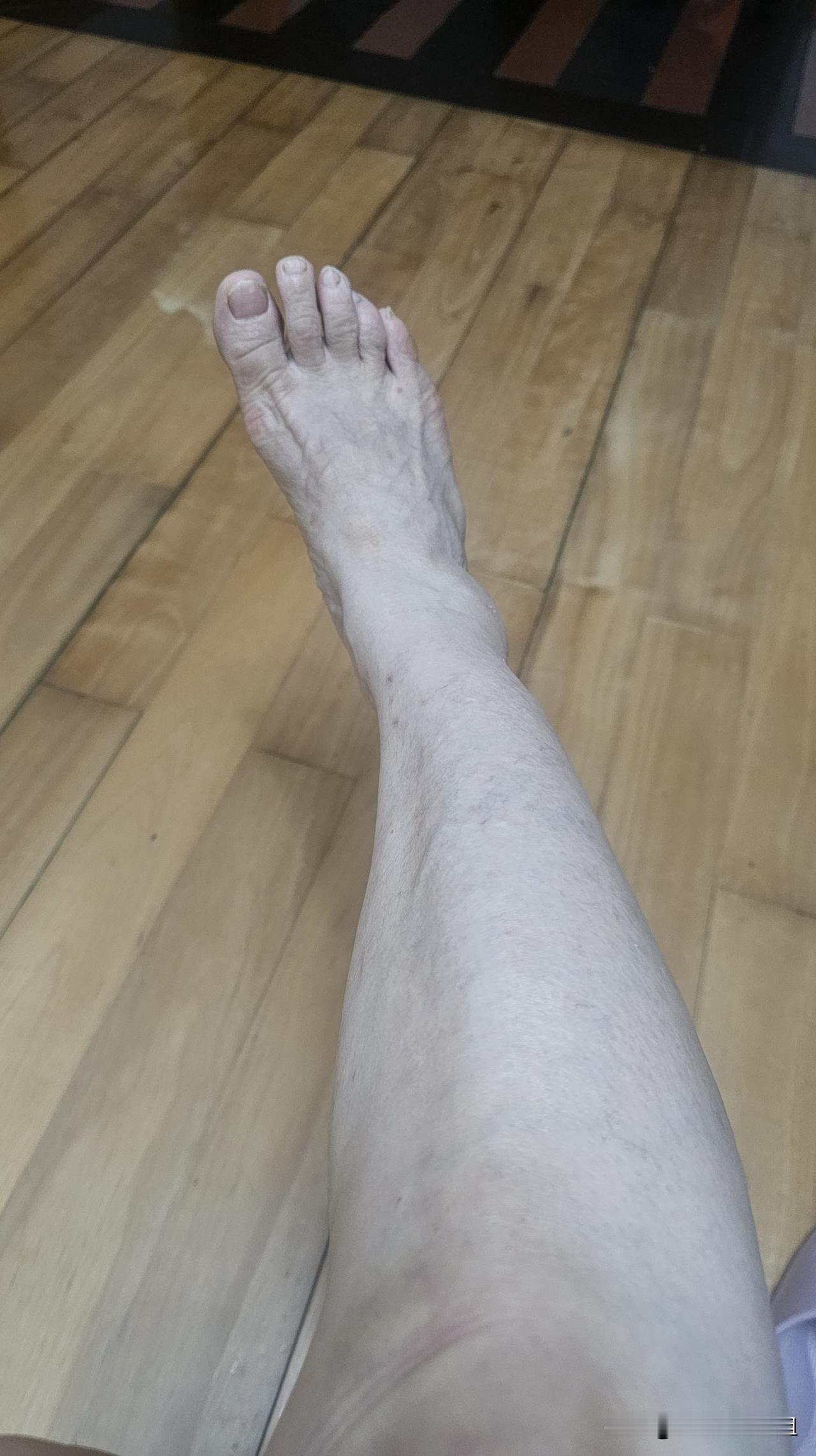 终于找到了小腿抽筋发硬的快速缓解之法。


早上睡醒，我习惯性伸了下腿，小腿瞬间