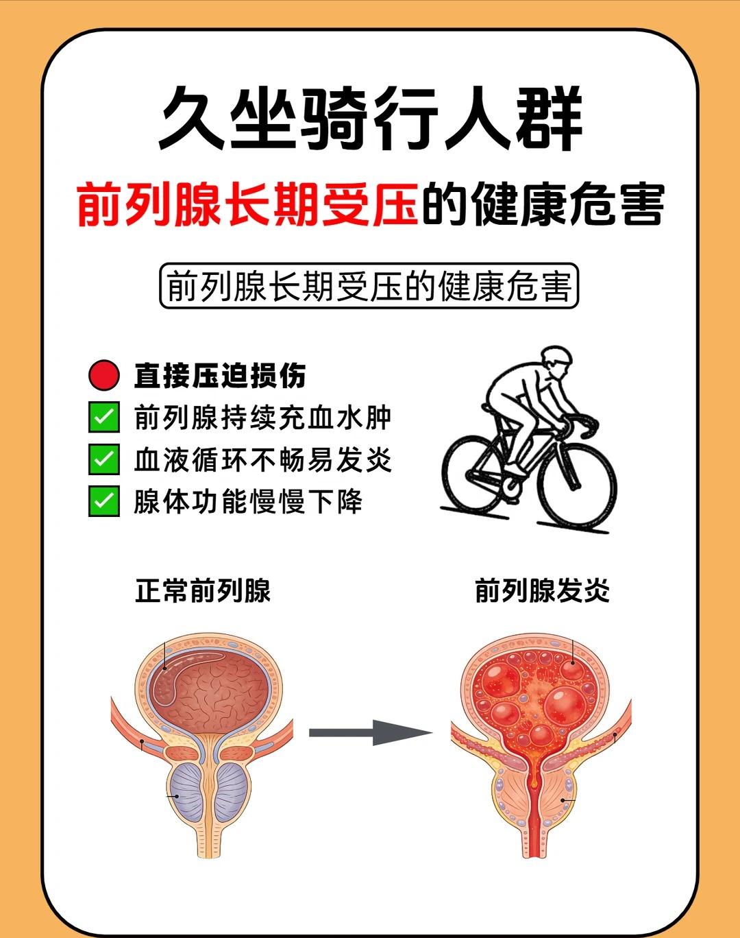 久坐与骑行人群注意：前列腺长期受压会带来哪些健康隐患