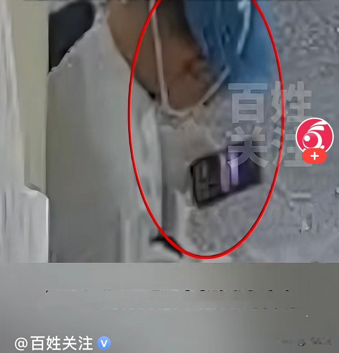 近日，西安刘先生的妻子，年仅 37岁，因做气管镜检查。谁也没想到，一场普通的常规