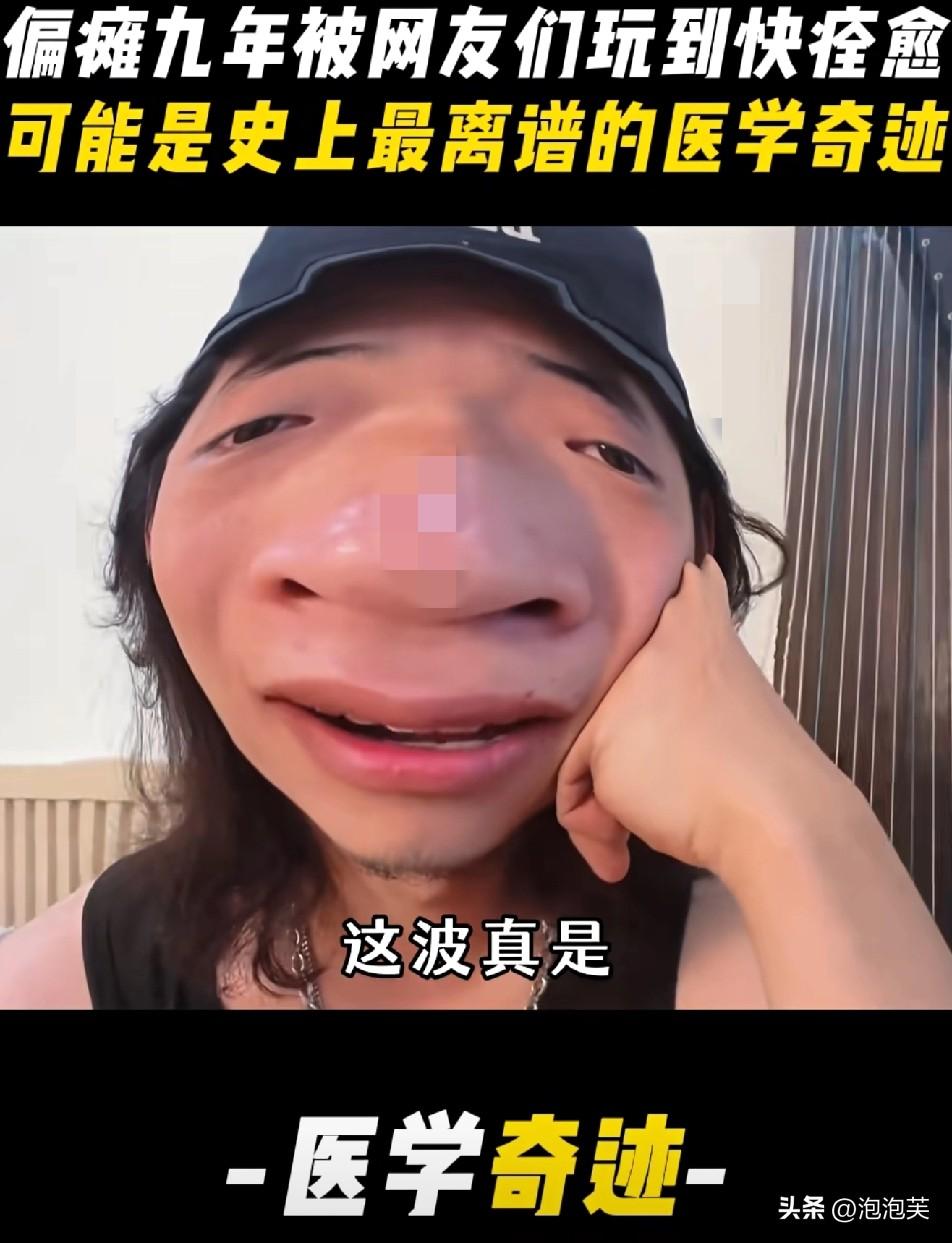 瘫痪九年的人

被网友“玩”出康复奇迹

笑疯了

山东有个叫“小蛋不服输”的小