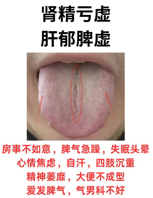 3 种脏腑失调舌象辨证