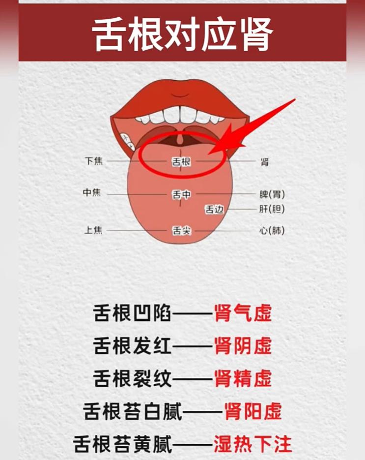 一张舌诊图看懂五脏：舌尖、舌边、舌中、舌根分别代表什么