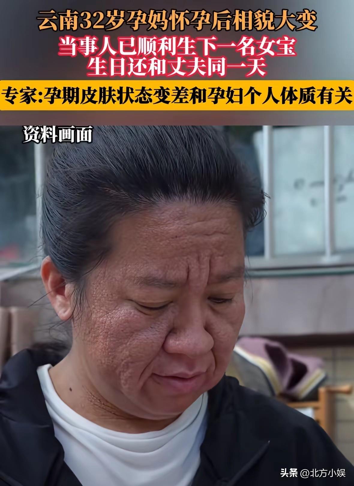 云南32岁宝妈孕期相貌大变，一下老了几十岁！
 
云南的32岁宝妈阿芹，孕期容貌