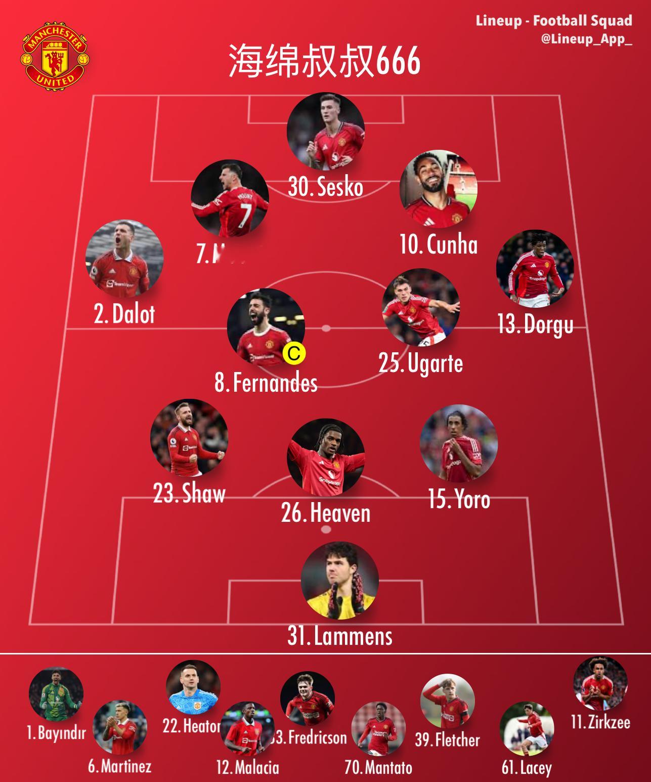 阿斯顿维拉vs曼联曼联英超 看看到底是3还是4 梅努应该是周六受伤了，至于是不是