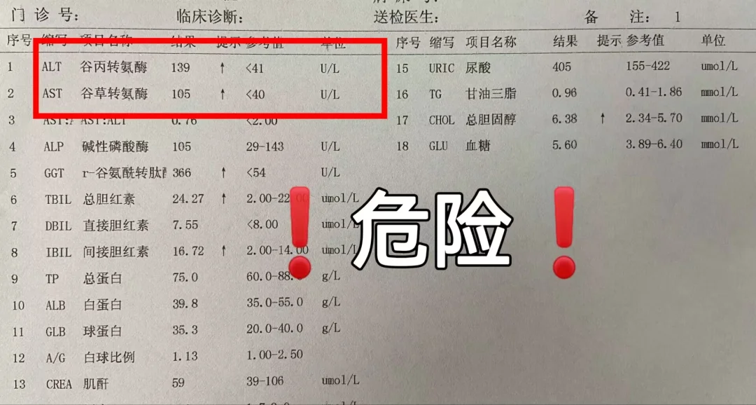 转氨酶高到多少要住院？