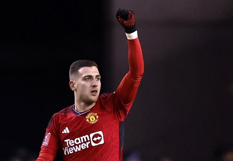 达洛特和多尔古，你们不配穿曼联球衣，第一个丢人达洛特你是完全不盯人防守，错失一个