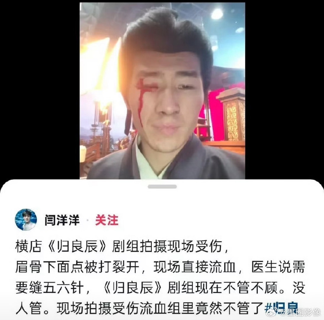 好可怜的群演！《归良辰》剧组群演眉骨裂开但是剧组不管，群演直接无奈发声了。 