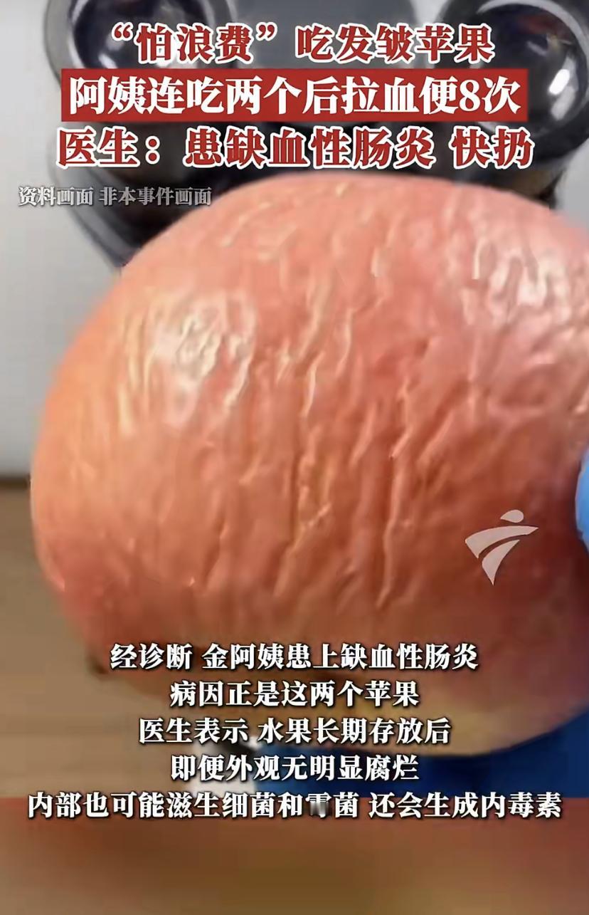 浙江的金阿姨，看家里放了两个月的苹果皮都皱了，觉得扔了可惜，一口气吃了两个。
第