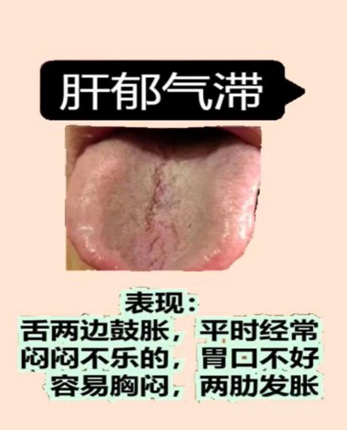 通过舌形辨别肝气问题，三种常见证型一次讲清