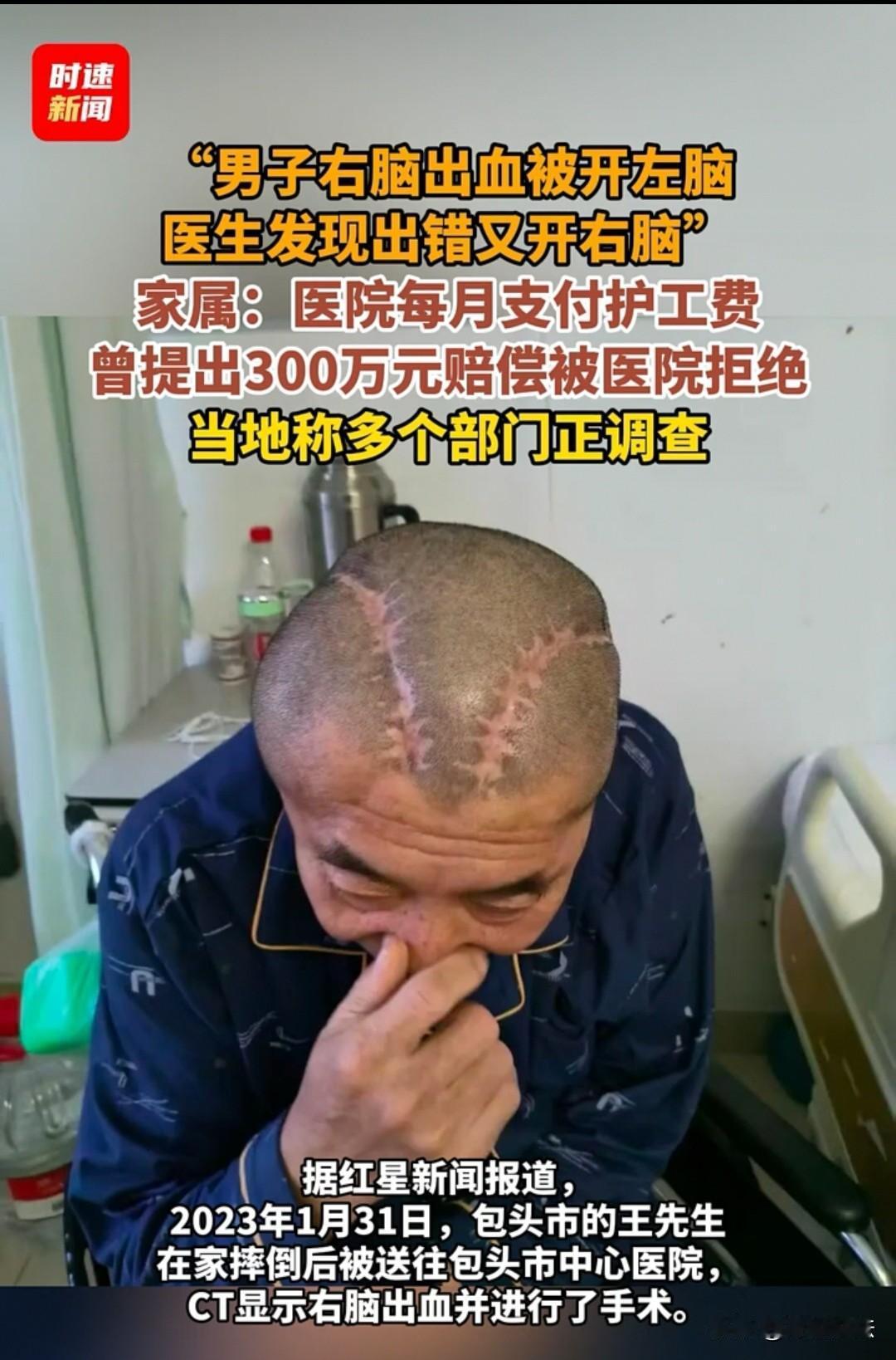 包头，男子在家摔了一跤，查出右脑出血，医生却开了左脑手术，他妻子瞥见伤口，当时就