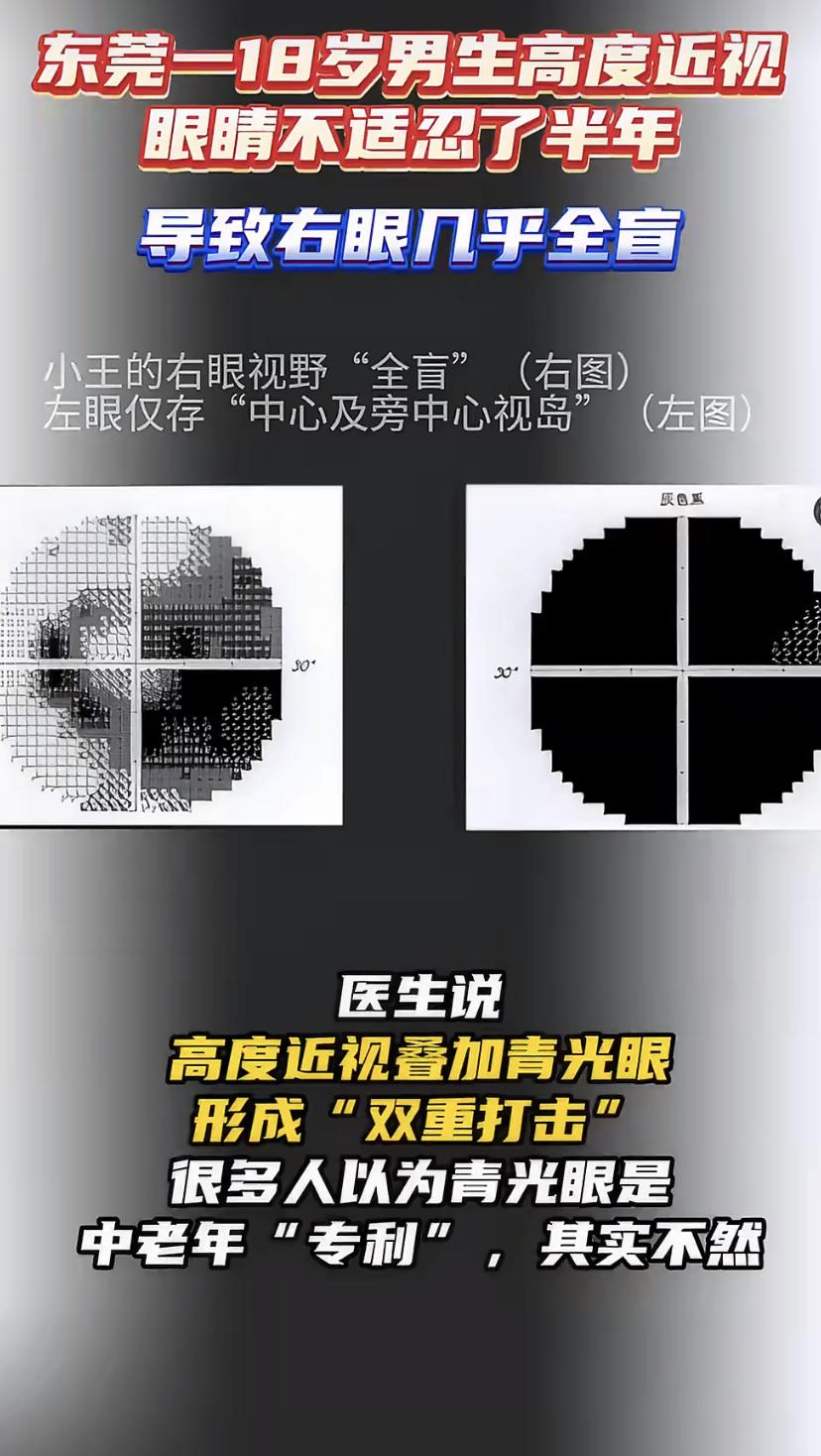 18岁小伙眼睛疼了半年，一查右眼竟然快瞎了!医生痛心：很多人还在犯这个错
东莞1