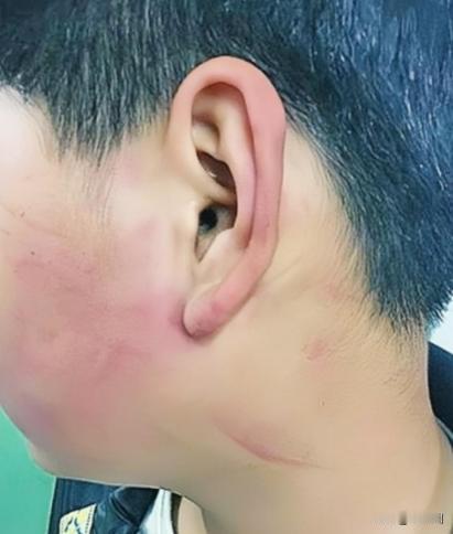 2019年，四川一名校长，因学生调皮，扇了他几巴掌，被孩子母亲逼着赔礼道歉。不料