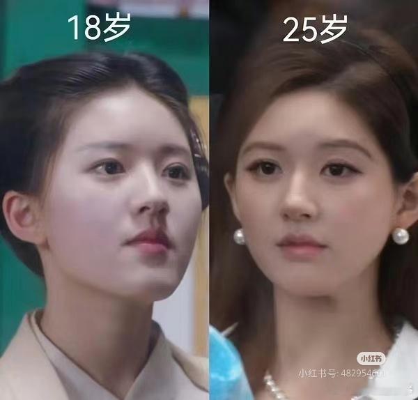 粉丝之前嘴硬，现在没办法了故作轻松承认医美了也没啥[笑cry]脸打的啪啪响 ​​