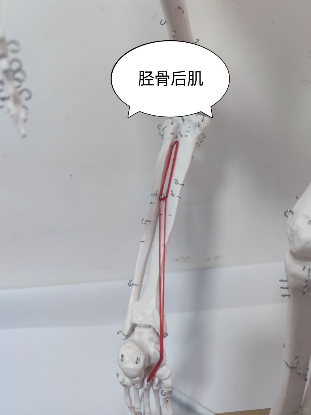 胫骨后肌