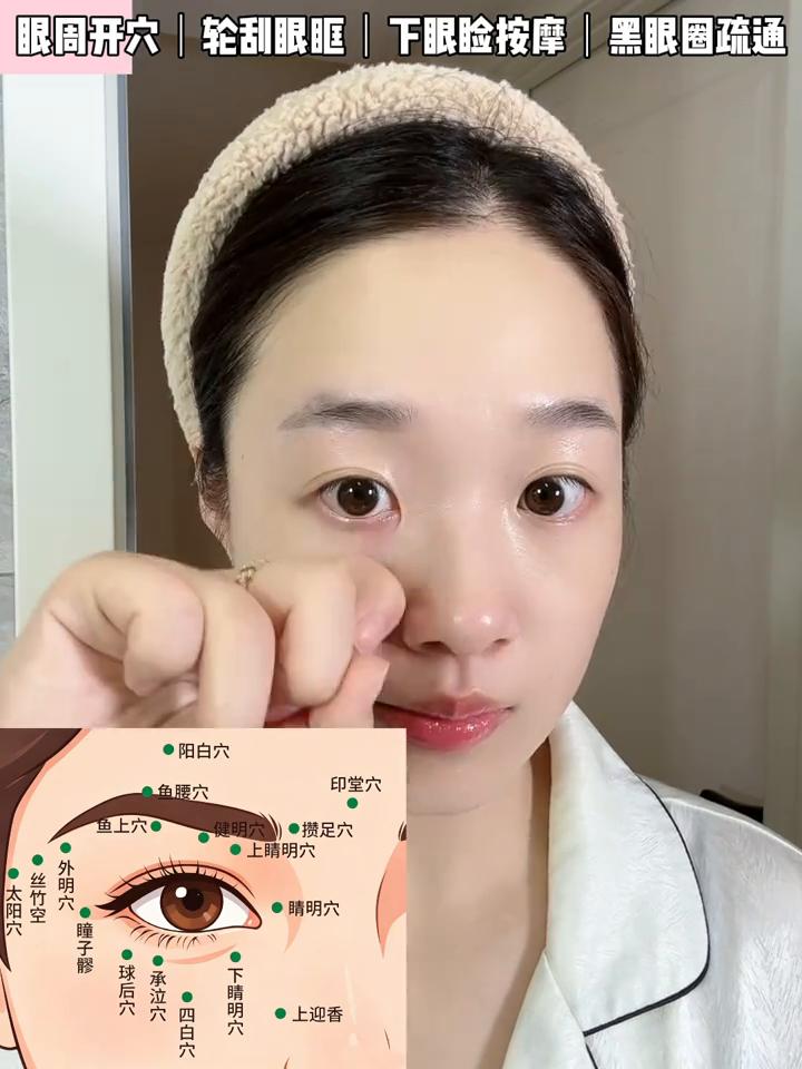 泪沟黑眼圈反复揉散就好了。
黑眼圈其实就是一坨淤血，给它揉散，反复的揉散，是不是