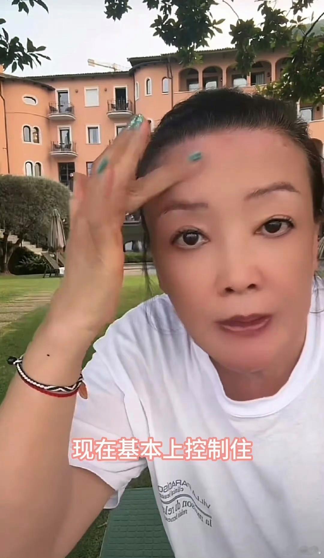 张兰治个白癜风还要去意大利，是中国治不好吗？ ​​​