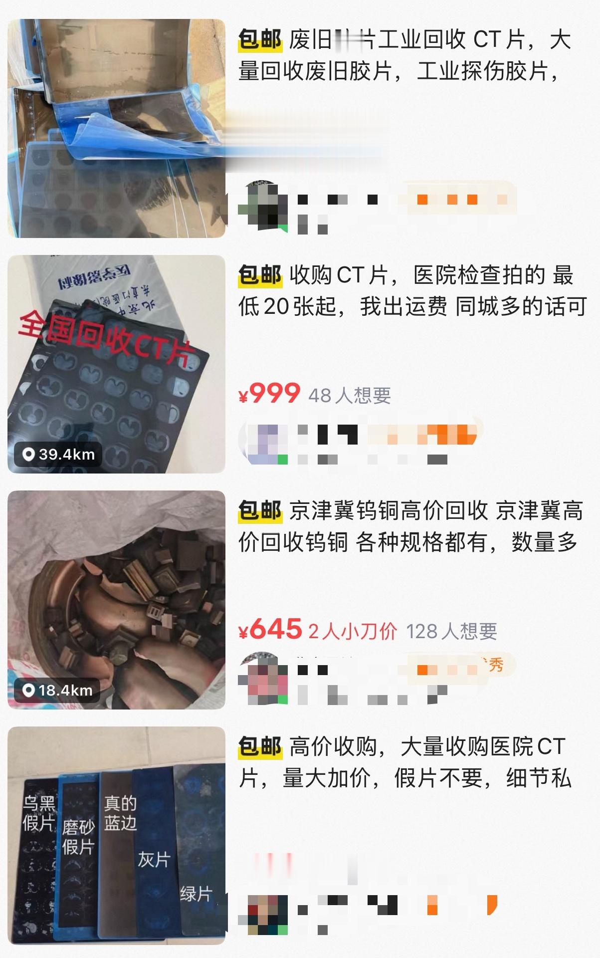 废旧CT片回收能炼银？紧急提醒：污染环境还涉嫌违法