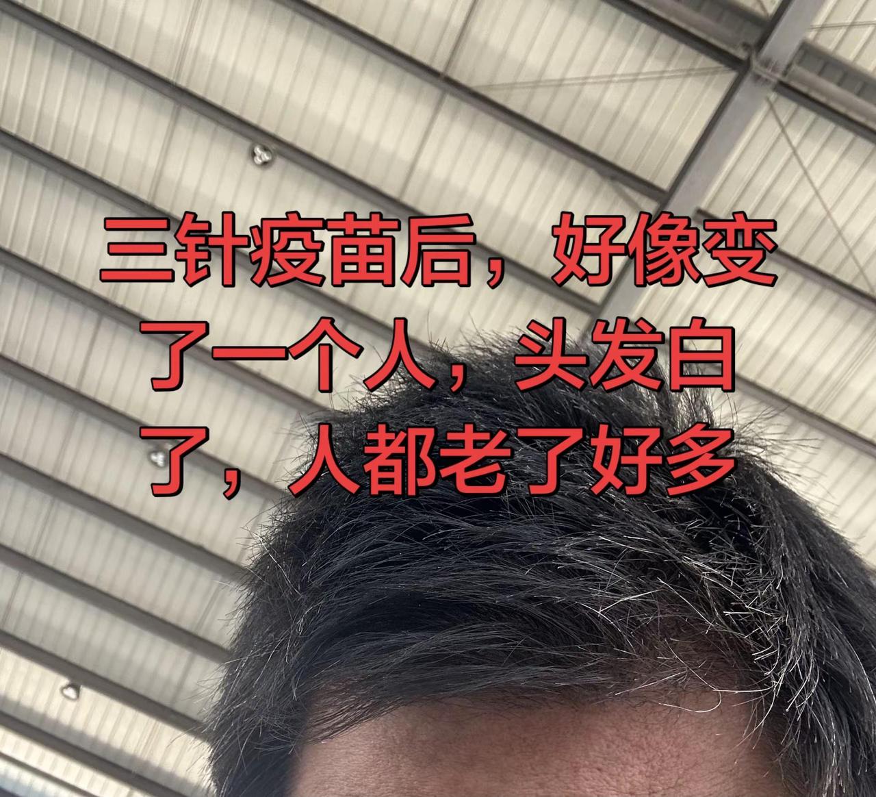 头发白了，还没到年龄就老了，80后的集合