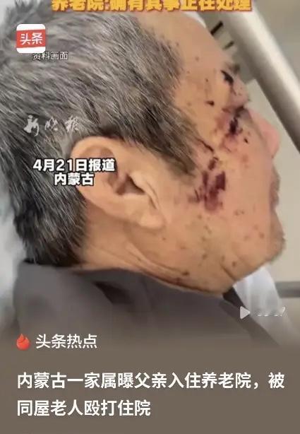 木棍打断三节！老人在养老院遭同屋毒打2小时，护工竟称“没办法”？

花钱送父母去