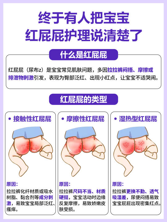 宝宝红屁屁❓夏季护臀实战秘籍大公开❗