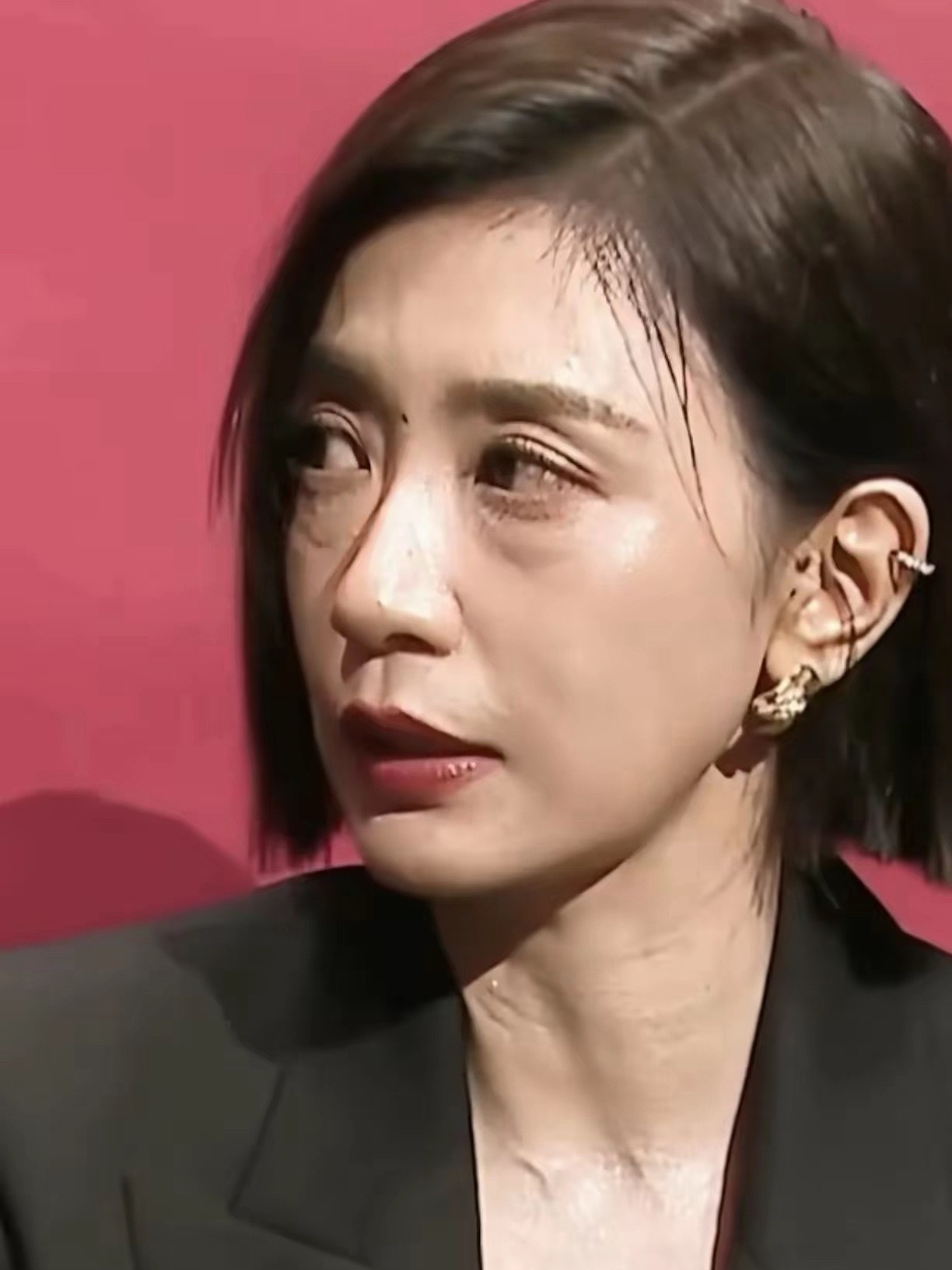 贾静雯眼袋黑眼圈也太明显了，如今医美这么发达，把眼袋去掉会更年轻。 