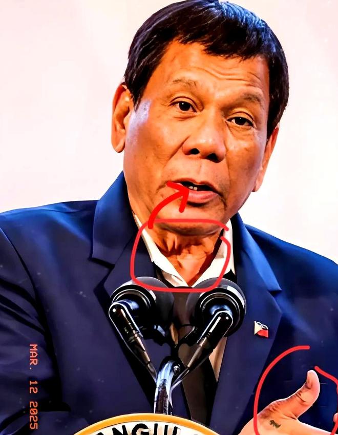 2026年1月26日，国际刑事法院正式裁定，80岁的菲律宾前总统杜特尔特身体状况