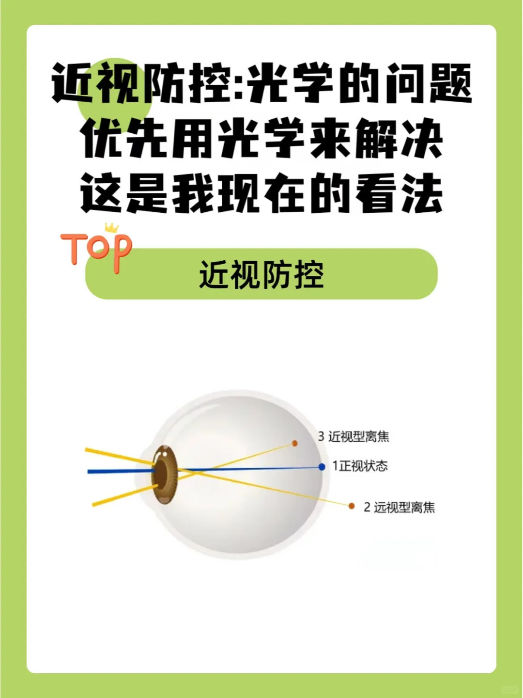 近视防控:光学的问题优先用光学来解决