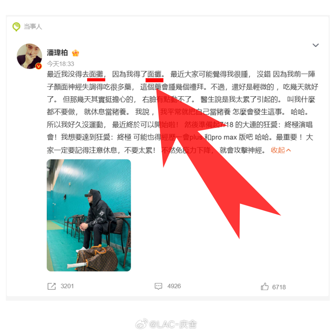 潘玮柏得了面瘫  以为是整活搞抽象没想到是真生病了面瘫在医学上被叫做面神经麻痹任